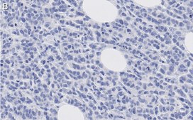 Anti-phosphotyrosine Antibody, clone 4G10 ZooMAb® Mouse Monoclonal recombinant, expressed in HEK 293 cells