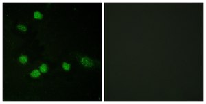 Anti-C-RAF, C-Terminal antibody produced in rabbit affinity isolated antibody