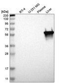 Anti-PKLR antibody produced in rabbit Prestige Antibodies® Powered by Atlas Antibodies, affinity isolated antibody