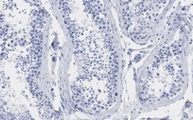 Anti-HSC70 Antibody, clone 1B15 ZooMAb® Rabbit Monoclonal recombinant, expressed in HEK 293 cells