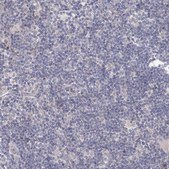 Anti-TACC2 antibody produced in rabbit Prestige Antibodies® Powered by Atlas Antibodies, affinity isolated antibody, buffered aqueous glycerol solution