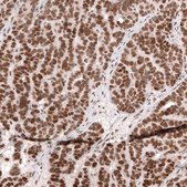 Monoclonal Anti-Smarcb1 Antibody Produced In Mouse Prestige Antibodies® Powered by Atlas Antibodies, clone CL13992, affinity isolated antibody, buffered aqueous glycerol solution