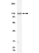 Anti-Vinculin Antibody, clone V284 clone V284, Upstate®, from mouse