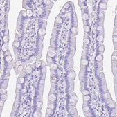 Anti-KCNC1 antibody produced in rabbit Prestige Antibodies® Powered by Atlas Antibodies, affinity isolated antibody, buffered aqueous glycerol solution