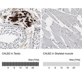Anti-CALB2 antibody produced in rabbit Prestige Antibodies® Powered by Atlas Antibodies, affinity isolated antibody, buffered aqueous glycerol solution
