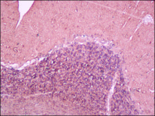 Anti-Neuron-Specific Enolase (NSE), Mouse monoclonal clone NSE-P1, purified from hybridoma cell culture