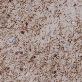 Monoclonal Anti-CNP antibody produced in mouse Prestige Antibodies® Powered by Atlas Antibodies, clone CL2871, purified immunoglobulin, buffered aqueous glycerol solution