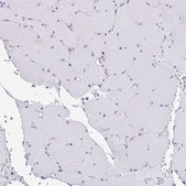 Anti-MYH10 antibody produced in rabbit Prestige Antibodies® Powered by Atlas Antibodies, affinity isolated antibody, buffered aqueous glycerol solution