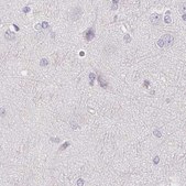 Anti-CSN1S1 antibody produced in rabbit Prestige Antibodies® Powered by Atlas Antibodies, affinity isolated antibody