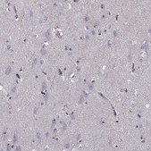 Anti-SHMT1 antibody produced in rabbit Prestige Antibodies® Powered by Atlas Antibodies, affinity isolated antibody, buffered aqueous glycerol solution