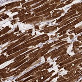 Monoclonal Anti-MYH6 antibody produced in mouse Prestige Antibodies® Powered by Atlas Antibodies, clone CL2162, purified immunoglobulin, buffered aqueous glycerol solution