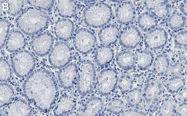 Anti-PAK-1 Antibody, clone 1H5 ZooMAb® Rabbit Monoclonal recombinant, expressed in HEK 293 cells