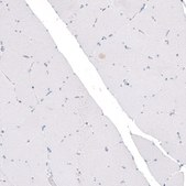 Monoclonal Anti-CDKL5 antibody produced in mouse Prestige Antibodies® Powered by Atlas Antibodies, clone CL4881, purified immunoglobulin, buffered aqueous glycerol solution