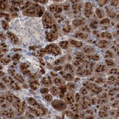Anti-ADRB2 antibody produced in rabbit Prestige Antibodies® Powered by Atlas Antibodies, affinity isolated antibody, buffered aqueous glycerol solution
