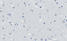 Anti-Renin Receptor Antibody, clone 1C22 ZooMAb® Rabbit Monoclonal recombinant, expressed in HEK 293 cells