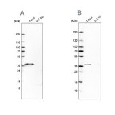 Anti-MS4A1 antibody produced in rabbit Prestige Antibodies® Powered by Atlas Antibodies, affinity isolated antibody, buffered aqueous glycerol solution