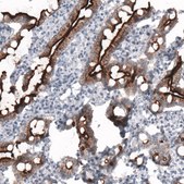 Monoclonal Anti-ACE2 antibody produced in mouse Prestige Antibodies® Powered by Atlas Antibodies, clone CL4013, purified immunoglobulin