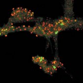 Anti-Sodium Channel Antibody, Voltage Gated, Pan (SP19 Segment) Chemicon®, from rabbit