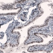 Monoclonal Anti-METTL14 antibody produced in mouse Prestige Antibodies® Powered by Atlas Antibodies, clone CL4254, purified immunoglobulin