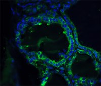 Anti-ORAI1 antibody produced in rabbit affinity isolated antibody, buffered aqueous solution