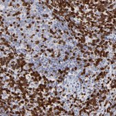Anti-ZAP70 antibody produced in rabbit Prestige Antibodies® Powered by Atlas Antibodies, affinity isolated antibody, buffered aqueous glycerol solution