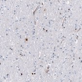 Monoclonal Anti-SERPINA3 antibody produced in mouse Prestige Antibodies® Powered by Atlas Antibodies, clone CL10697, purified antibody (Protein A)