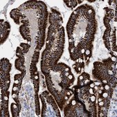 Anti-MTFR1 antibody produced in rabbit Prestige Antibodies® Powered by Atlas Antibodies, affinity isolated antibody, buffered aqueous glycerol solution