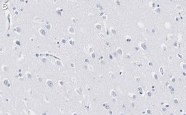 Anti-ADAM10 Antibody, clone 1F3 ZooMAb® Rabbit Monoclonal recombinant, expressed in HEK 293 cells