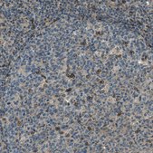 Anti-LEMD2 antibody produced in rabbit Prestige Antibodies® Powered by Atlas Antibodies, affinity isolated antibody, buffered aqueous glycerol solution