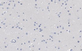 Anti-Nuclei Antibody, clone 3E1.3 ZooMAb® Mouse Monoclonal recombinant, expressed in HEK 293 cells
