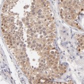 Anti-UBE2E3 antibody produced in rabbit Prestige Antibodies® Powered by Atlas Antibodies, affinity isolated antibody, buffered aqueous glycerol solution
