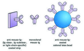 IsoStrip™ Mouse Monoclonal Antibody Isotyping Kit sufficient for 10 tests