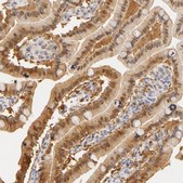 Anti-CA2 antibody produced in rabbit Prestige Antibodies® Powered by Atlas Antibodies, affinity isolated antibody, buffered aqueous glycerol solution