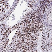 Anti-TRIM28 antibody produced in rabbit Prestige Antibodies® Powered by Atlas Antibodies, affinity isolated antibody, buffered aqueous glycerol solution