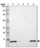 Anti-ATP5D antibody produced in rabbit Prestige Antibodies® Powered by Atlas Antibodies, affinity isolated antibody, buffered aqueous glycerol solution