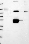 Anti-FGG antibody produced in rabbit Prestige Antibodies® Powered by Atlas Antibodies, affinity isolated antibody, buffered aqueous glycerol solution