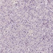 Anti-MAP1A antibody produced in rabbit Prestige Antibodies® Powered by Atlas Antibodies, affinity isolated antibody, buffered aqueous glycerol solution