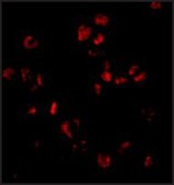 Anti-Sumo antibody produced in rabbit affinity isolated antibody, buffered aqueous solution