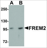 Anti-FREM2 antibody produced in rabbit affinity isolated antibody, buffered aqueous solution