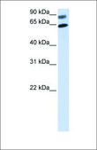 Anti-DVL2 antibody produced in rabbit affinity isolated antibody
