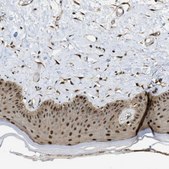 Anti-PSMC5 antibody produced in rabbit Prestige Antibodies® Powered by Atlas Antibodies, affinity isolated antibody, buffered aqueous glycerol solution