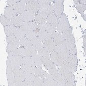 Anti-ATP11C antibody produced in rabbit Prestige Antibodies® Powered by Atlas Antibodies, affinity isolated antibody, buffered aqueous glycerol solution