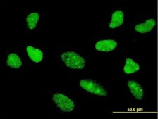 Monoclonal Anti-TCF7 antibody produced in mouse clone 1D2, purified immunoglobulin, buffered aqueous solution