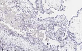 Anti-FAK Antibody, clone 1D14 ZooMAb® Rabbit Monoclonal recombinant, expressed in HEK 293 cells