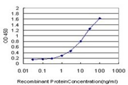 ANTI-STAT5B antibody produced in mouse clone 1F5, purified immunoglobulin, buffered aqueous solution