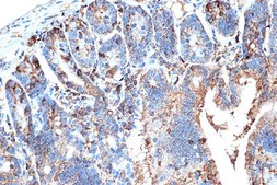 Anti-FABPI antibody produced in rabbit