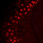 Anti-tp63 antibody produced in rabbit affinity isolated antibody, buffered aqueous solution