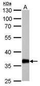 Anti-AKR1C1 antibody produced in rabbit affinity isolated antibody, buffered aqueous solution