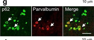 Anti-Parvalbumin Antibody ascites fluid, clone PARV-19, Chemicon®