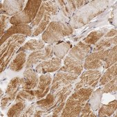 Anti-CYC1 antibody produced in rabbit Prestige Antibodies® Powered by Atlas Antibodies, affinity isolated antibody, buffered aqueous glycerol solution